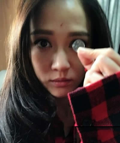 X